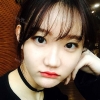 (Two-jaw) + Ar + T (red) + Transparent correction + F.g (Forehead) + (Positive) Ni (ptosis) + Epi — Korea cost, reviews & before-after | MISOODA