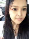 fg (forehead, zygoma), ni (fat), rhino (using donated cartilage and if more is needed ear cartilage) — Korea cost, reviews & before-after | MISOODA