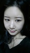 It's already been a year since I had the surgery~ — Korea cost, reviews & before-after | MISOODA