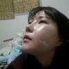 Ar + Zy (PPC) + T / adv + NI / ptosis + Rhino / lo #Free — Korea cost, reviews & before-after | MISOODA