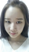 It's already been a year since I had the surgery~ — Korea cost, reviews & before-after | MISOODA