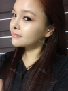 fg (forehead, zygoma), ni (fat), rhino (using donated cartilage and if more is needed ear cartilage) — Korea cost, reviews & before-after | MISOODA