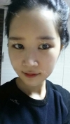 It's already been a year since I had the surgery~ — Korea cost, reviews & before-after | MISOODA