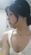 Ar + Zy + T / length extension — Korea cost, reviews & before-after | MISOODA