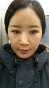 It's already been a year since I had the surgery~ — Korea cost, reviews & before-after | MISOODA