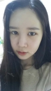 It's already been a year since I had the surgery~ — Korea cost, reviews & before-after | MISOODA