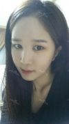 It's already been a year since I had the surgery~ — Korea cost, reviews & before-after | MISOODA