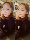 Ar + Zy + T / long hair + forehead / sil + epi + Rhino — Korea cost, reviews & before-after | MISOODA