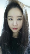 It's already been a year since I had the surgery~ — Korea cost, reviews & before-after | MISOODA