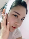 Ar + Zy + T + LP (jaw line) + thread lifting + (tack) Rhino (re) — Korea cost, reviews & before-after | MISOODA