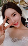 Ar + Zy + T + LP (jaw line) + thread lifting + (tack) Rhino (re) — Korea cost, reviews & before-after | MISOODA