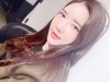 Ar + Zy + T + LP (jaw line) + thread lifting + (tack) Rhino (re) — Korea cost, reviews & before-after | MISOODA