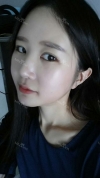It's already been a year since I had the surgery~ — Korea cost, reviews & before-after | MISOODA