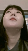 Ar + Zy (PPC) + T / adv + NI / ptosis + Rhino / lo #Free — Korea cost, reviews & before-after | MISOODA