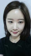 It's already been a year since I had the surgery~ — Korea cost, reviews & before-after | MISOODA