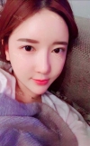 Ar + Zy + T + LP (jaw line) + thread lifting + (tack) Rhino (re) — Korea cost, reviews & before-after | MISOODA