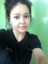 fg (forehead, zygoma), ni (fat), rhino (using donated cartilage and if more is needed ear cartilage) — Korea cost, reviews & before-after | MISOODA