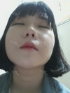 Ar + Zy (PPC) + T / adv + NI / ptosis + Rhino / lo #Free — Korea cost, reviews & before-after | MISOODA