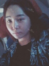 Ar + Zy + T / long hair + forehead / sil + epi + Rhino — Korea cost, reviews & before-after | MISOODA