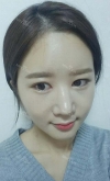 It's already been a year since I had the surgery~ — Korea cost, reviews & before-after | MISOODA