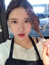 Ar + Zy + T + LP (jaw line) + thread lifting + (tack) Rhino (re) — Korea cost, reviews & before-after | MISOODA
