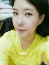 Ar + Zy (PPC) + T / adv + NI / ptosis + Rhino / lo #Free — Korea cost, reviews & before-after | MISOODA