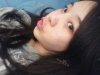 ar zy t (adv heading), fg (forehead), rhino (lo), pa (sil), aky ni (ptosis re), lat — Korea cost, reviews & before-after | MISOODA