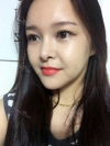 fg (forehead, zygoma), ni (fat), rhino (using donated cartilage and if more is needed ear cartilage) — Korea cost, reviews & before-after | MISOODA