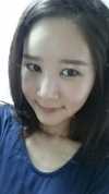 It's already been a year since I had the surgery~ — Korea cost, reviews & before-after | MISOODA