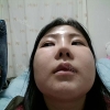Ar + Zy (PPC) + T / adv + NI / ptosis + Rhino / lo #Free — Korea cost, reviews & before-after | MISOODA