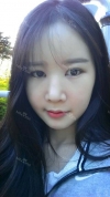 It's already been a year since I had the surgery~ — Korea cost, reviews & before-after | MISOODA