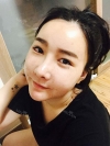 Ar + Zy + T + Pa (sil) + Rhino + weir + Ni (re) ptosis + Lat — Korea cost, reviews & before-after | MISOODA