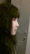 Ar + Zy (PPC) + T / adv + NI / ptosis + Rhino / lo #Free — Korea cost, reviews & before-after | MISOODA