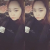 Ar + Zy + T / long hair + forehead / sil + epi + Rhino — Korea cost, reviews & before-after | MISOODA