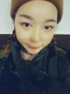 Ar + Zy + T / long hair + forehead / sil + epi + Rhino — Korea cost, reviews & before-after | MISOODA