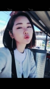 Ar + Zy + T / long hair + forehead / sil + epi + Rhino — Korea cost, reviews & before-after | MISOODA