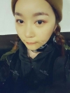 Ar + Zy + T / long hair + forehead / sil + epi + Rhino — Korea cost, reviews & before-after | MISOODA