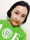 Ar + Zy + T + Pa (sil) + Rhino + weir + Ni (re) ptosis + Lat — Korea cost, reviews & before-after | MISOODA