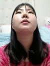 Ar + Zy (PPC) + T / adv + NI / ptosis + Rhino / lo #Free — Korea cost, reviews & before-after | MISOODA