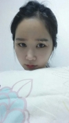 It's already been a year since I had the surgery~ — Korea cost, reviews & before-after | MISOODA