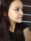 fg (forehead, zygoma), ni (fat), rhino (using donated cartilage and if more is needed ear cartilage) — Korea cost, reviews & before-after | MISOODA