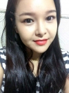 fg (forehead, zygoma), ni (fat), rhino (using donated cartilage and if more is needed ear cartilage) — Korea cost, reviews & before-after | MISOODA