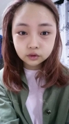 Ar + Zy + T / length extension — Korea cost, reviews & before-after | MISOODA
