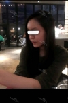 I did Thigh Liposuction and full face fat grafting, and nose filler injection. — Korea cost, reviews & before-after | MISOODA