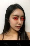 I did Thigh Liposuction and full face fat grafting, and nose filler injection. — Korea cost, reviews & before-after | MISOODA