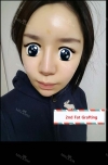Forehead Fat Grafting & Botox — Korea cost, reviews & before-after | MISOODA
