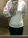Thigh + Abdomen Liposuction — Korea cost, reviews & before-after | MISOODA