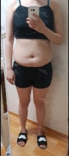 Everybody can't belived that I lost 13lbs in a month. — Korea cost, reviews & before-after | MISOODA