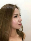 Jaw Reduction, Rhinoplasty and Breast Augmentation in Korea — Korea cost, reviews & before-after | MISOODA