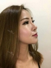 Jaw Reduction, Rhinoplasty and Breast Augmentation in Korea — Korea cost, reviews & before-after | MISOODA